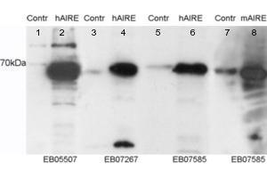 Western Blotting (WB) image for anti-DENN/MADD Domain Containing 4C (DENND4C) (C-Term) antibody (ABIN2790996) (DENND4C anticorps  (C-Term))