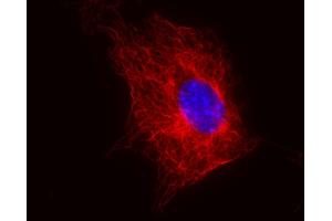 Immunocytochemistry staining of 3T3 mouse embryonal fibroblast cell line using anti-beta-tubulin (TU-06) (detection by Goat anti-mouse IgM Cy®5).