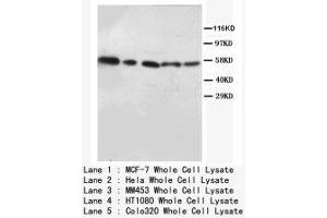 Image no. 2 for anti-V-Akt Murine Thymoma Viral Oncogene Homolog 1/2 (AKT1/2) (N-Term) antibody (ABIN1494209) (AKT1/2 anticorps  (N-Term))