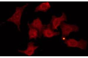 ABIN6274257 staining Hela by IF/ICC.