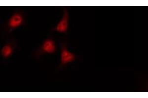 ABIN6267334 staining A549 by IF/ICC.