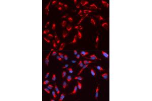 Immunofluorescence analysis of U2OS cell using WASL antibody. (Neural Wiskott-Aldrich syndrome protein (WASL) (AA 1-250) anticorps)