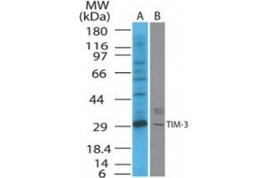 Image no. 1 for anti-Hepatitis A Virus Cellular Receptor 2 (TIM 3) (AA 100-200) antibody (ABIN208461) (TIM3 anticorps  (AA 100-200))