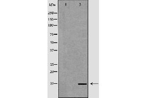 Western blot analysis of extracts of Caco-2 lysate, using CCL21 antibody. (CCL21 anticorps  (C-Term))
