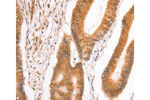 Immunohistochemistry (IHC) image for anti-Tax1 (Human T-Cell Leukemia Virus Type I) Binding Protein 1 (TAX1BP1) antibody (ABIN2828089) (TAX1BP1 anticorps)