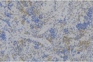 ABIN6279701 at 1/100 staining Human lymph node tissue by IHC-P. (CD164 anticorps  (Internal Region))