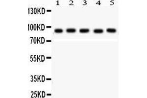 Western Blotting (WB) image for anti-Signal Transducer and Activator of Transcription 5B (STAT5B) (AA 675-703), (C-Term) antibody (ABIN3042740)