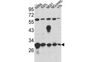 Western Blotting (WB) image for anti-Endoplasmic Reticulum Protein 29 (ERP29) antibody (ABIN3001703) (ERP29 anticorps)