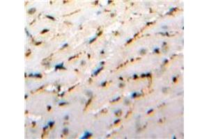 Used in DAB staining on fromalin fixed paraffin-embedded Heart tissue (IL-33 anticorps  (AA 112-270))