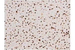 ABIN6267604 at 1/200 staining Mouse heart tissue sections by IHC-P.