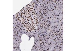 Immunohistochemical staining of human pancreas with GPKOW polyclonal antibody  shows strong nuclear positivity in exocrine glandular cells and islet cells at 1:50-1:200 dilution. (GPKOW anticorps)