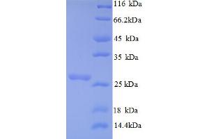 SDS-PAGE (SDS) image for Vacuolar Protein Sorting 13 Homolog B (Yeast) (VPS13B) (AA 4-200), (partial) protein (His tag) (ABIN5713014)