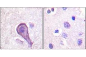 Immunohistochemistry analysis of paraffin-embedded human brain tissue, using Rhodopsin (Ab-334) Antibody. (Rhodopsin anticorps  (AA 299-348))