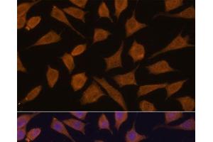 Immunofluorescence analysis of L929 cells using SEPT3 Polyclonal Antibody at dilution of 1:100.