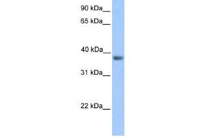 WB Suggested Anti-NEUROD6 Antibody Titration:  0. (NEUROD6 anticorps  (Middle Region))