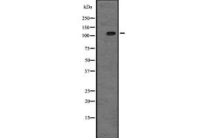 Western blot analysis of TAOK2 expression in A431 whole cell lysate ,The lane on the left is treated with the antigen-specific peptide. (TAO Kinase 2 anticorps  (Internal Region))