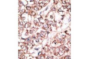 Image no. 3 for anti-Dickkopf 2 Homolog (DKK2) (N-Term) antibody (ABIN357069)