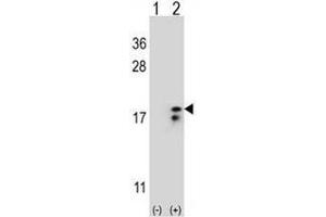 Western blot analysis of COX6A1 (arrow) using rabbit polyclonal COX6A1 Antibody (Center) . (Complex IV Subunit VIaL (AA 57-86), (Middle Region) anticorps)