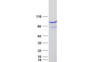 Validation with Western Blot