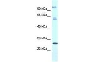 Image no. 1 for anti-Transmembrane Protein 222 (TMEM222) (AA 106-155) antibody (ABIN6747477)
