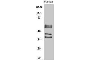 Western Blotting (WB) image for anti-Periphilin 1 (PPHLN1) (Internal Region) antibody (ABIN3186395) (PPHLN1 anticorps  (Internal Region))