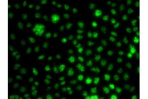 Immunofluorescence analysis of A549 cell using UBE2R2 antibody. (UBE2R2 anticorps)