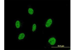 Immunofluorescence of monoclonal antibody to SIX2 on HeLa cell. (SIX2 anticorps  (AA 1-291))