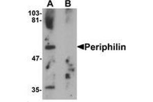 Western blot analysis of Periphilin in mouse colon tissue lysate with Periphilin Antibody   at 1 ug/mL in (A) the absence and (B) the presence of blocking peptide. (PPHLN1 anticorps  (Middle Region))