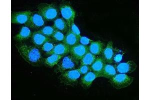 IF analysis of OXCT1/SCOT using anti-OXCT1/SCOT antibody (ABIN7601419). (OXCT1 anticorps  (AA 35-309))