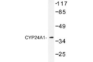 Image no. 1 for anti-Cytochrome P450, Family 24, Subfamily A, Polypeptide 1 (CYP24A1) antibody (ABIN272271) (CYP24A1 anticorps)