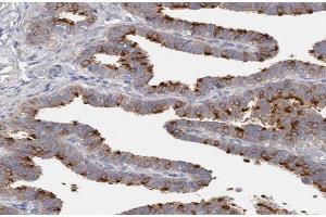 ABIN6266939 at 1/100 staining human Fallopian tube tissue sections by IHC-P. (DLEC1 anticorps  (N-Term))