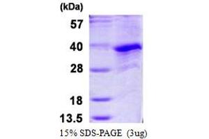 SDS-PAGE (SDS) image for Cyclin G1 (CCNG1) (AA 1-295) protein (His tag) (ABIN667630)
