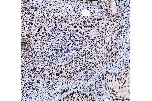 IHC analysis of HDAC2 using anti-HDAC2 antibody (ABIN7601564). (HDAC2 anticorps  (AA 387-488))