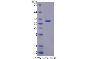 SDS-PAGE analysis of Rat CACNa1S Protein.