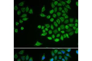 Immunofluorescence analysis of MCF-7 cells using PTPN2 Polyclonal Antibody (PTPN2 anticorps)