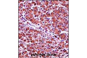 CELA3B Antibody (N-term) (ABIN657692 and ABIN2846683) immunohistochemistry analysis in formalin fixed and paraffin embedded human pancreas tissue followed by peroxidase conjugation of the secondary antibody and DAB staining.