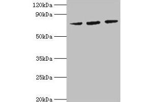 Western blot All lanes: HSPA6 antibody at 2 μg/mL Lane 1: MCF-7 whole cell lysate Lane 2: A431 whole cell lysate Lane 3: Jurkat whole cell lysate Secondary Goat polyclonal to rabbit IgG at 1/10000 dilution Predicted band size: 72 kDa Observed band size: 72 kDa (HSPA6 anticorps  (AA 1-637))