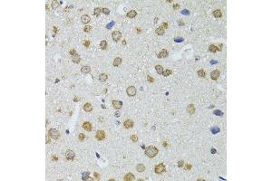 Immunohistochemistry of paraffin-embedded mouse brain using RNASEL antibody.