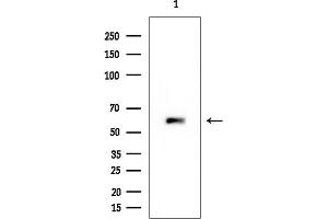 anti-EPS8-Like 1 (EPS8L1) antibody