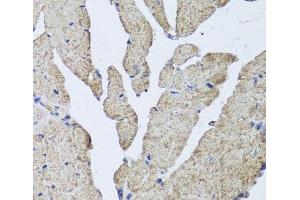 Immunohistochemistry of paraffin-embedded Mouse heart using HBA2 Polyclonal Antibody at dilution of 1:100 (40x lens). (HBa2 anticorps)