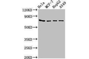 Western Blot Positive WB detected in: Hela whole cell lysate, MCF-7 whole cell lysate, HepG2 whole cell lysate, A549 whole cell lysate All lanes: HSPA5 antibody at 4 μg/mL Secondary Goat polyclonal to rabbit IgG at 1/50000 dilution Predicted band size: 73 kDa Observed band size: 73 kDa