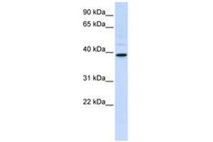 Image no. 1 for anti-Chitinase, Acidic (CHIA) (AA 108-157) antibody (ABIN6740778) (CHIA anticorps  (AA 108-157))