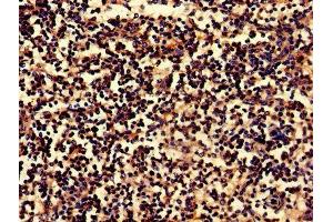 IHC image of ABIN7145158 diluted at 1:800 and staining in paraffin-embedded human spleen tissue performed on a Leica BondTM system.