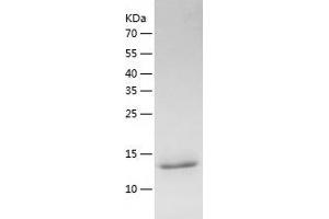 Western Blotting (WB) image for Dynein, Light Chain, Tctex-Type 3 (DYNLT3) (AA 1-116) protein (His tag) (ABIN7122725) (DYNLT3 Protein (AA 1-116) (His tag))