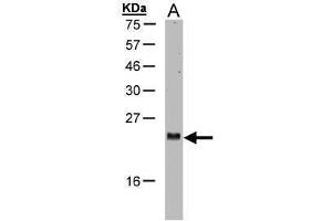 WB Image Sample(30 μg of whole cell lysate) A:H1299 15% SDS PAGE antibody diluted at 1:1000 (ARL2 anticorps  (C-Term))