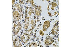 Immunohistochemistry of paraffin-embedded human stomach using CCNA2 antibody. (Cyclin A anticorps)