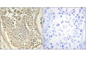 Immunohistochemistry analysis of paraffin-embedded human testis tissue, using ATP7B Antibody.