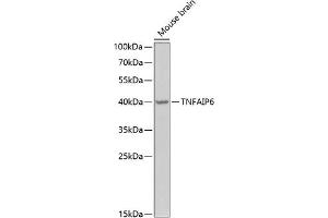 Western blot analysis of extracts of mouse brain, using TNF Antibody (ABIN6130740, ABIN6149294, ABIN6149295 and ABIN6222057) at 1:1000 dilution. (TNFAIP6 anticorps  (AA 18-277))