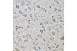 Immunohistochemistry of paraffin-embedded rat brain using CRYM antibody.