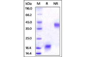 Human VEGF110 on SDS-PAGE under reducing (R) and no-reducing (NR) conditions. (VEGF110 (AA 27-136) (Active) Protéine)